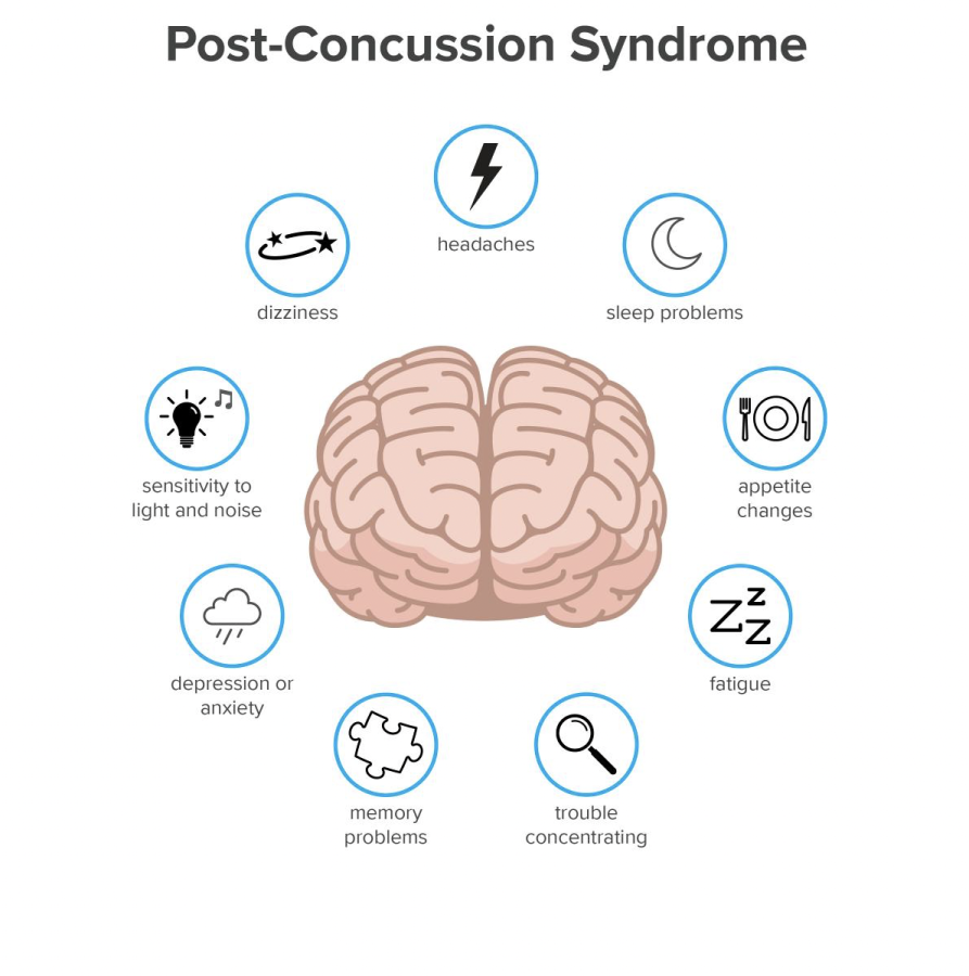 Exploring post concussion syndrome
